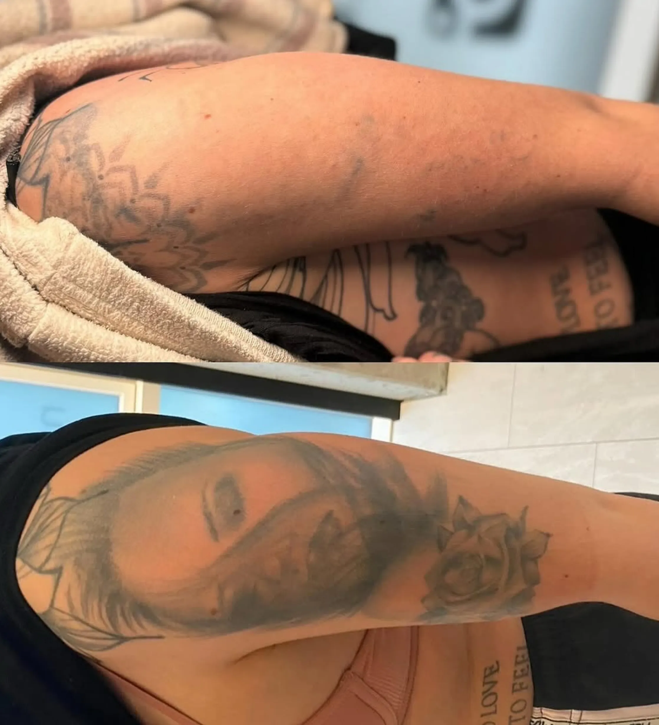 best cream for tattoo healing