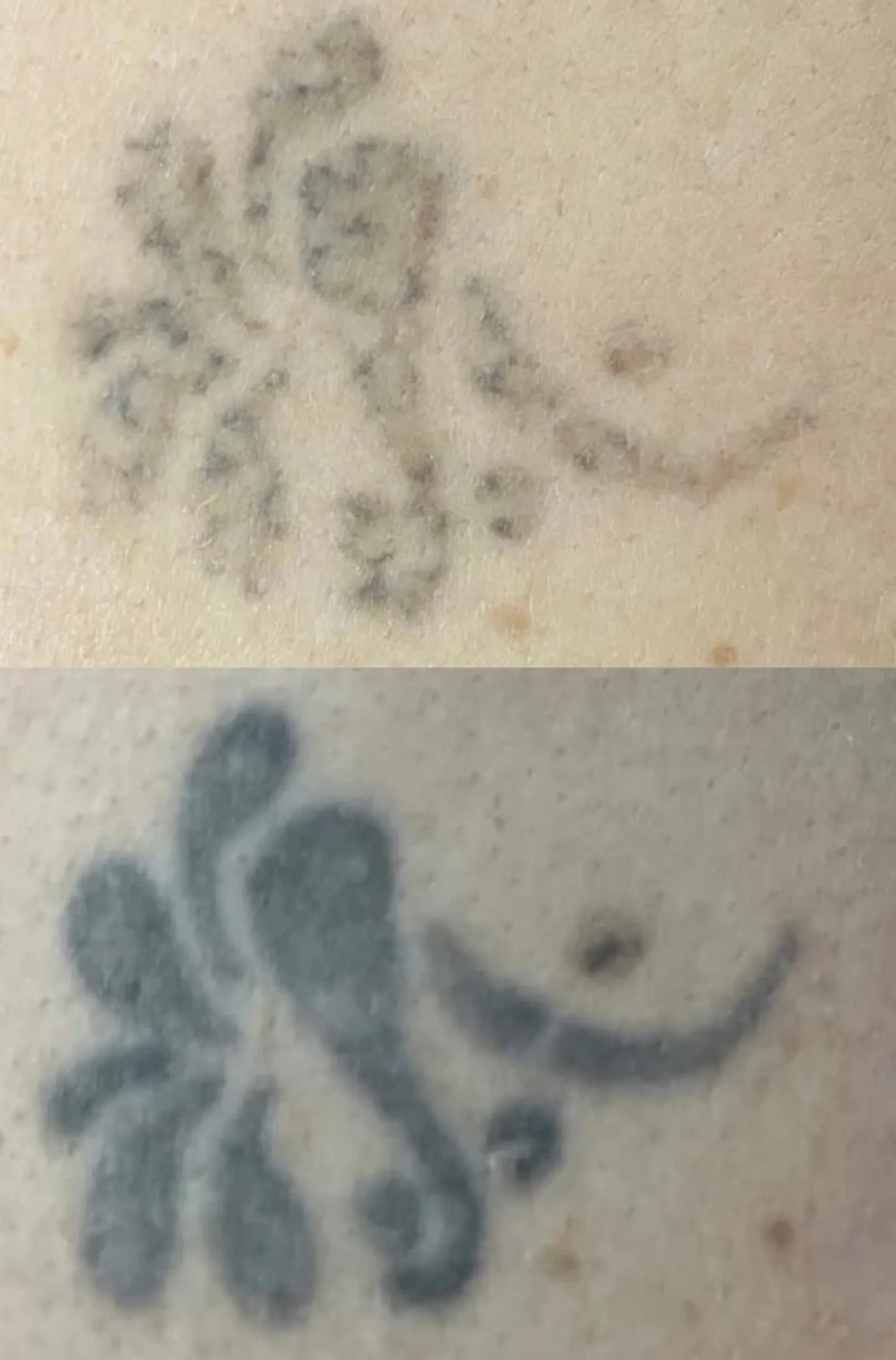 is Sudocrem safe for tattoos