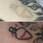 Can Sudocrem Fade Tattoos?