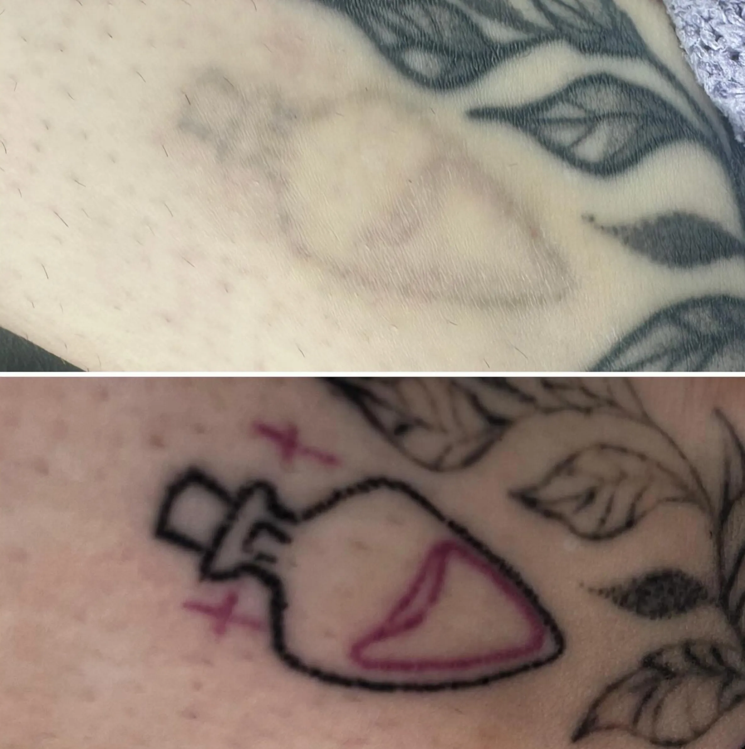 can Sudocrem fade tattoos