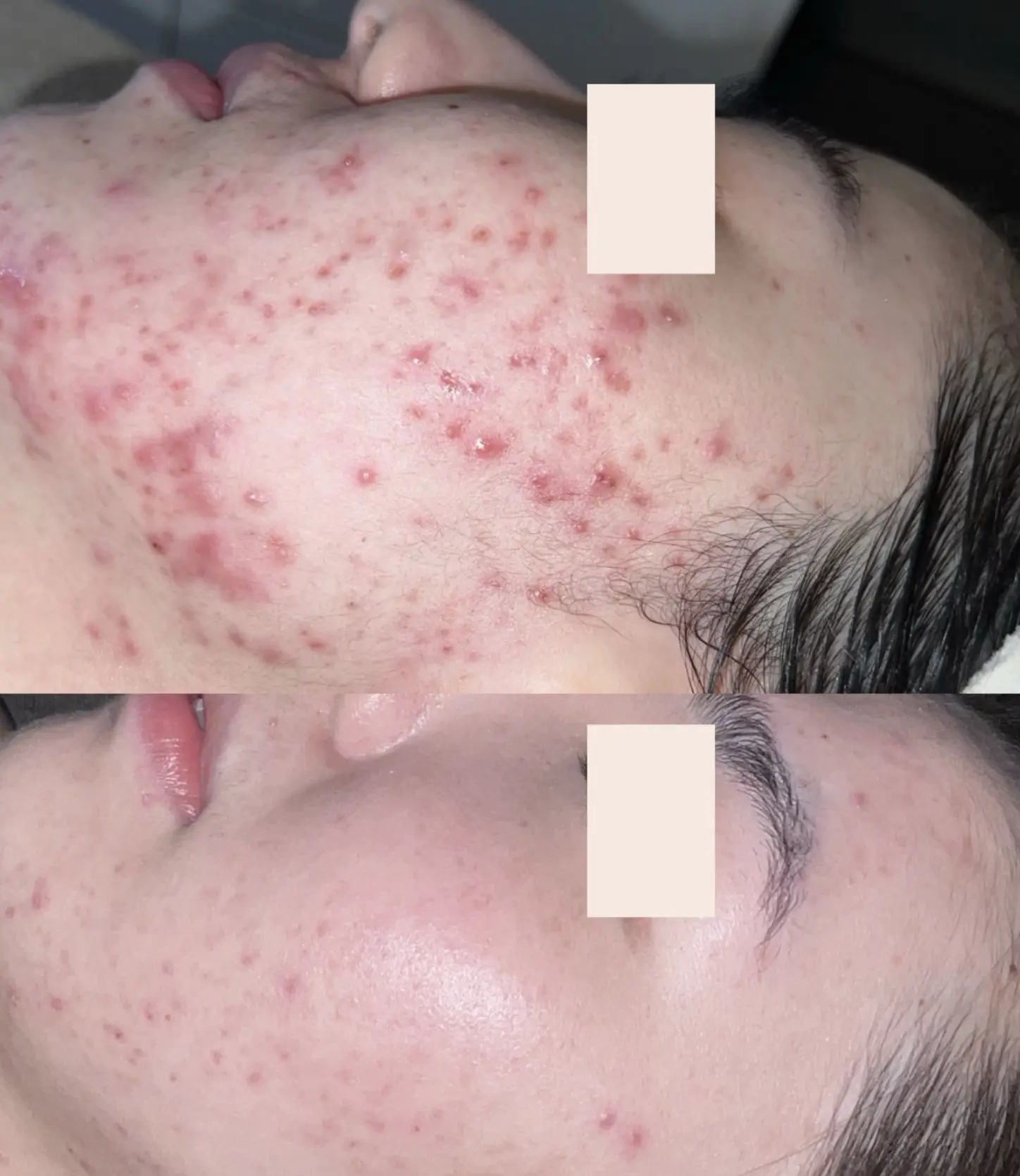 how to clear skin congestion