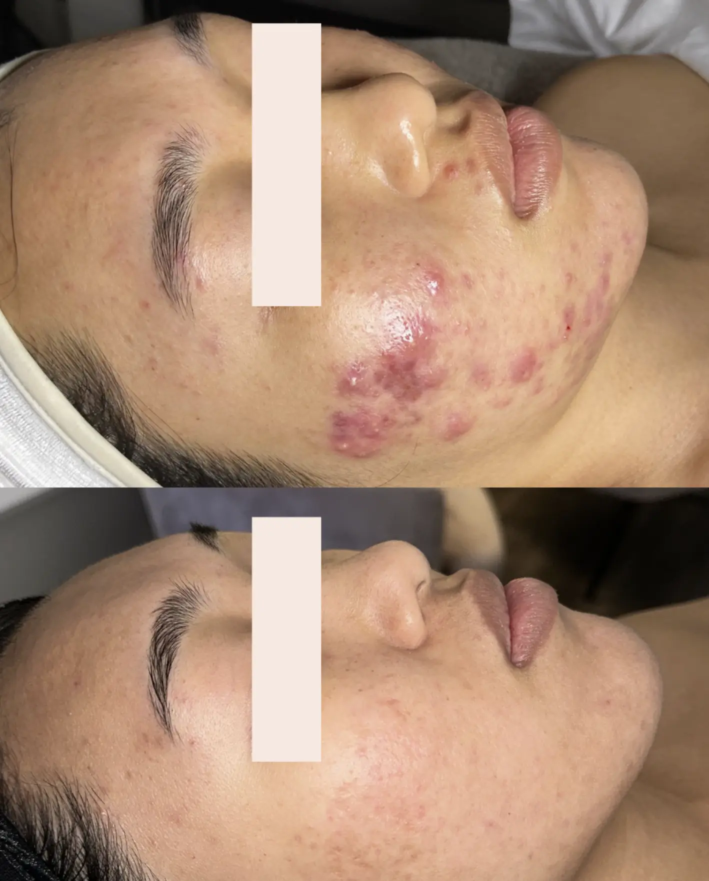 how to get rid of congested skin